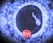 Bestand:2007 BNN sperm ident.jpg
